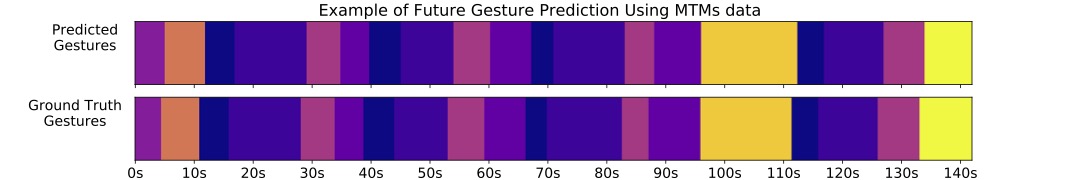 Surgical gesture prediction example
